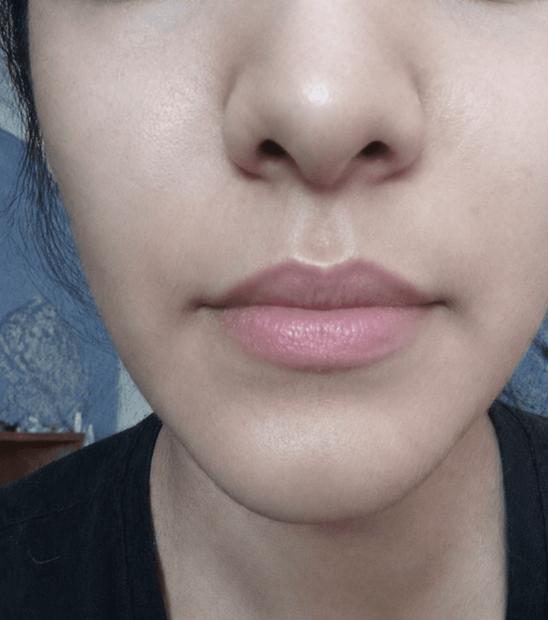 Review image from Dr Nilufa Anis