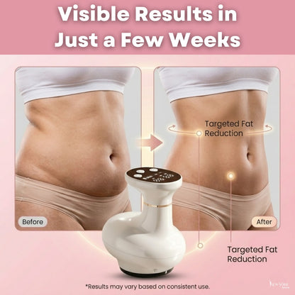Full Body & Belly Fat Burner Device [Rechargeable]