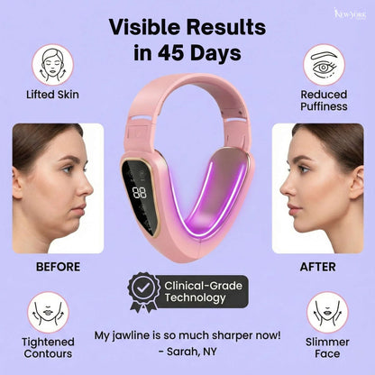 Face Fat & Double Chin Removal Device™ [Rechargeable]